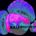Слушать Tremolo Ⅱ - Kaleidoscope Eyes онлайн